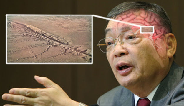 Fault Line In NHK Boss’s Brain Poses No Real Threat